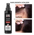 Arfa Cosmetics Hair Growth Minoxidil Spray Minoxidil 5% Hair Tonic For Hair Care Hair Loss and Hair Growth Premium Hair Care Product Women and Men All Hair Types 120Ml